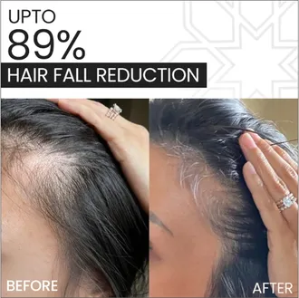 Novegrow Stem Serum 60 ml - Image 6